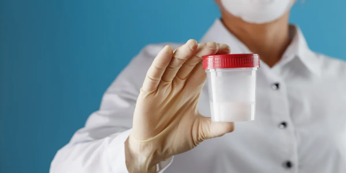 Próbka nasienia do badań w diagnostyce niepłodności męskiej