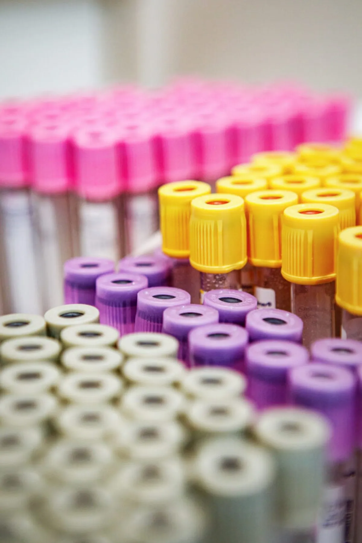Badania laboratoryjne wykorzystywane w diagnostyce otyłości